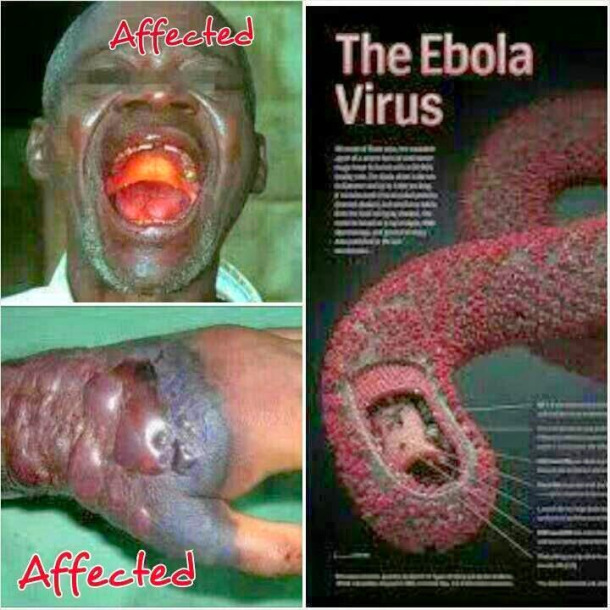 Ebola virus enters Lagos 411vibes