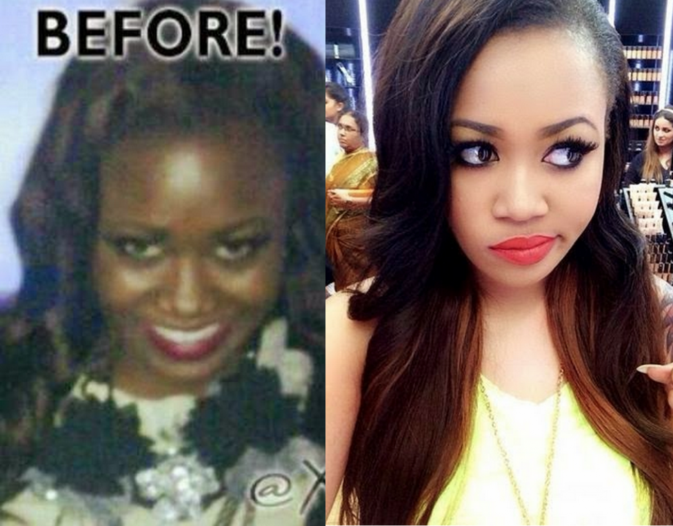 Must Read: Dangers of Skin Bleaching - Genechy Uju