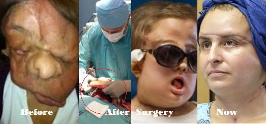 surgery1