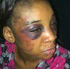 Graphic Photos: Nigerian Man Beats And Stabs His Wife In Her Private Part After Accusing Her Of Cheating 